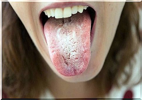 black spots on the tongue