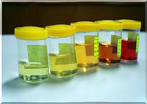 Change in urine: what to watch out for
