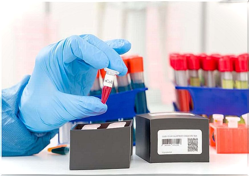 How does the Corona PCR test work?