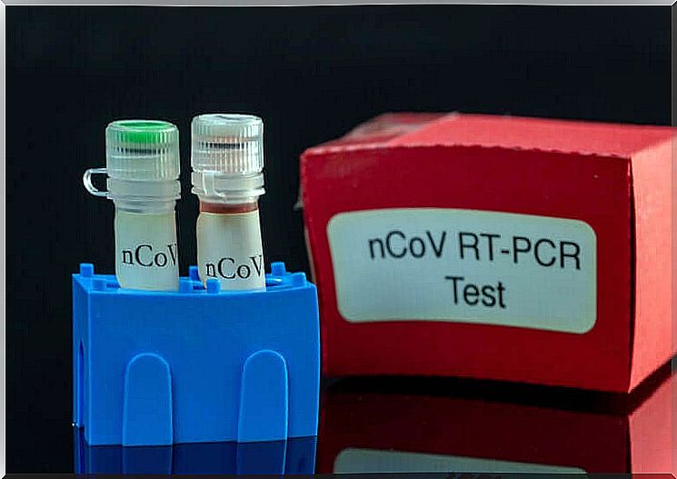 PCR test