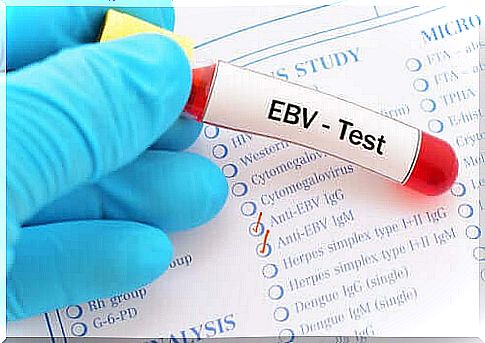 Mononucleosis - EBV test
