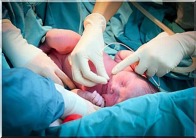 Baby after caesarean section