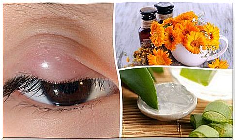 Stye: 7 Natural Home Remedies That Can Help