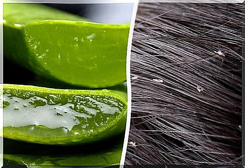 What could help against dandruff simply and effectively
